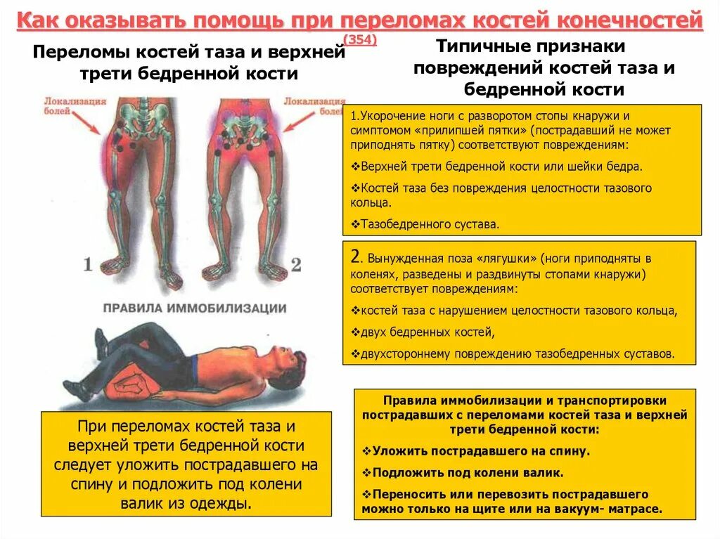 Сколько болит перелом ноги. Первая помощь при пррелома костей таза. Первая помощь при переломе костей таза. Првая помощь при ПРЛОМА костй таза.