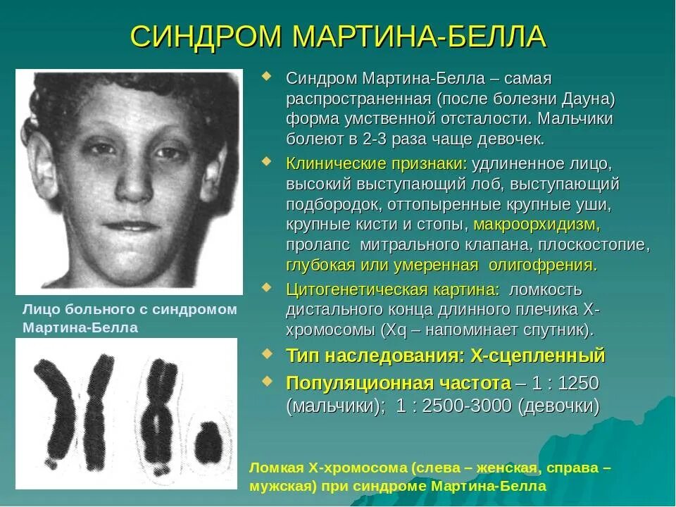 Синдром шерешевского-тернера (моносомия х). Синдром кошачьего крика тип наследования. Какие синдромы у человека. Какие синдромы у человека. Классификация синдромов.