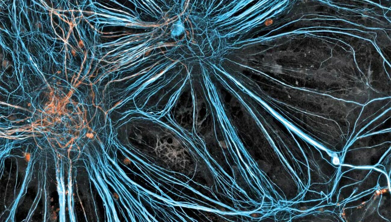 Нейронные боеприпасы. Нейронные микросети. Конфокальная микроскопия нейронов. Клетки головного мозга. Клетки мозга под микроскопом.