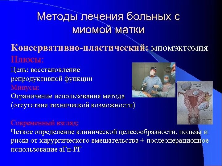 Алгоритмы ведения пациентов с миомой матки. Показания к миомэктомии. Подходы к лечению миомы матки. Консервативная терапия при миоме матки.