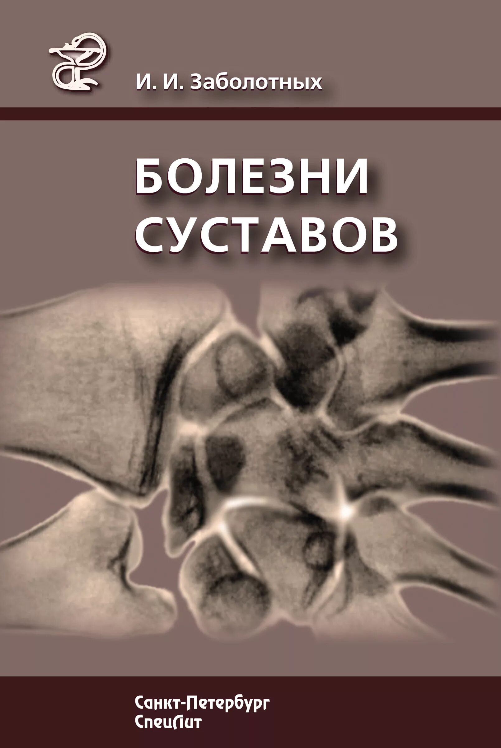 Болотная болезнь. Болезни суставов Заболотных и.и.. Болезни суставов книги. Болезни коленей книга. Справочник заболеваний суставов названия.