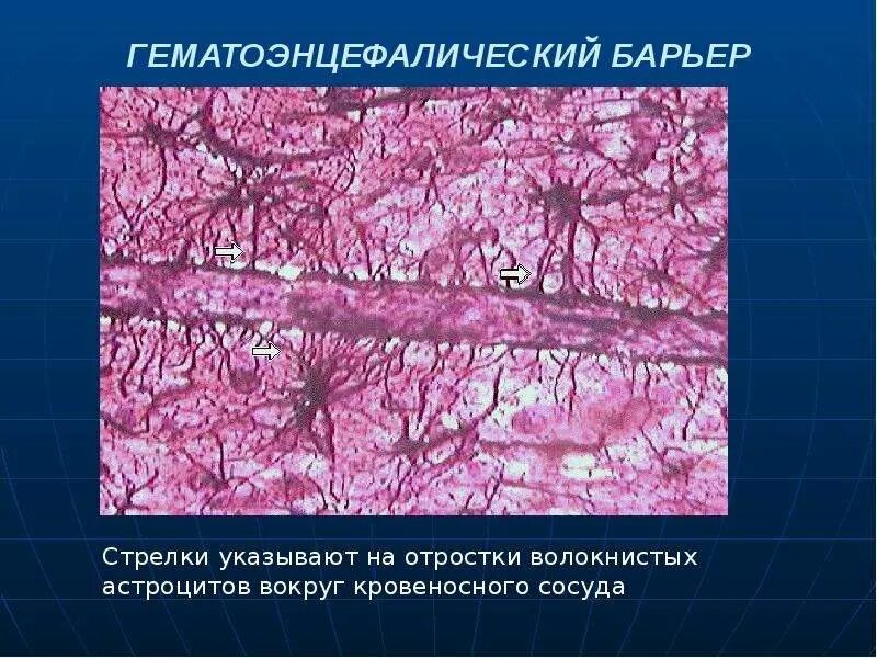 Барьеры гистология. Гематоэнцефалический барьер гистология. гематоэнцефалический барьер гистология строение. гематоэнцефалический барьер головного мозга. гематоэнцефалический барьер гистология препарат.