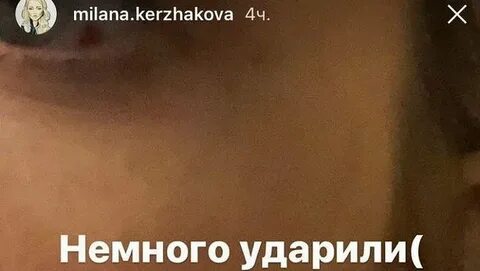 Ударил слегка