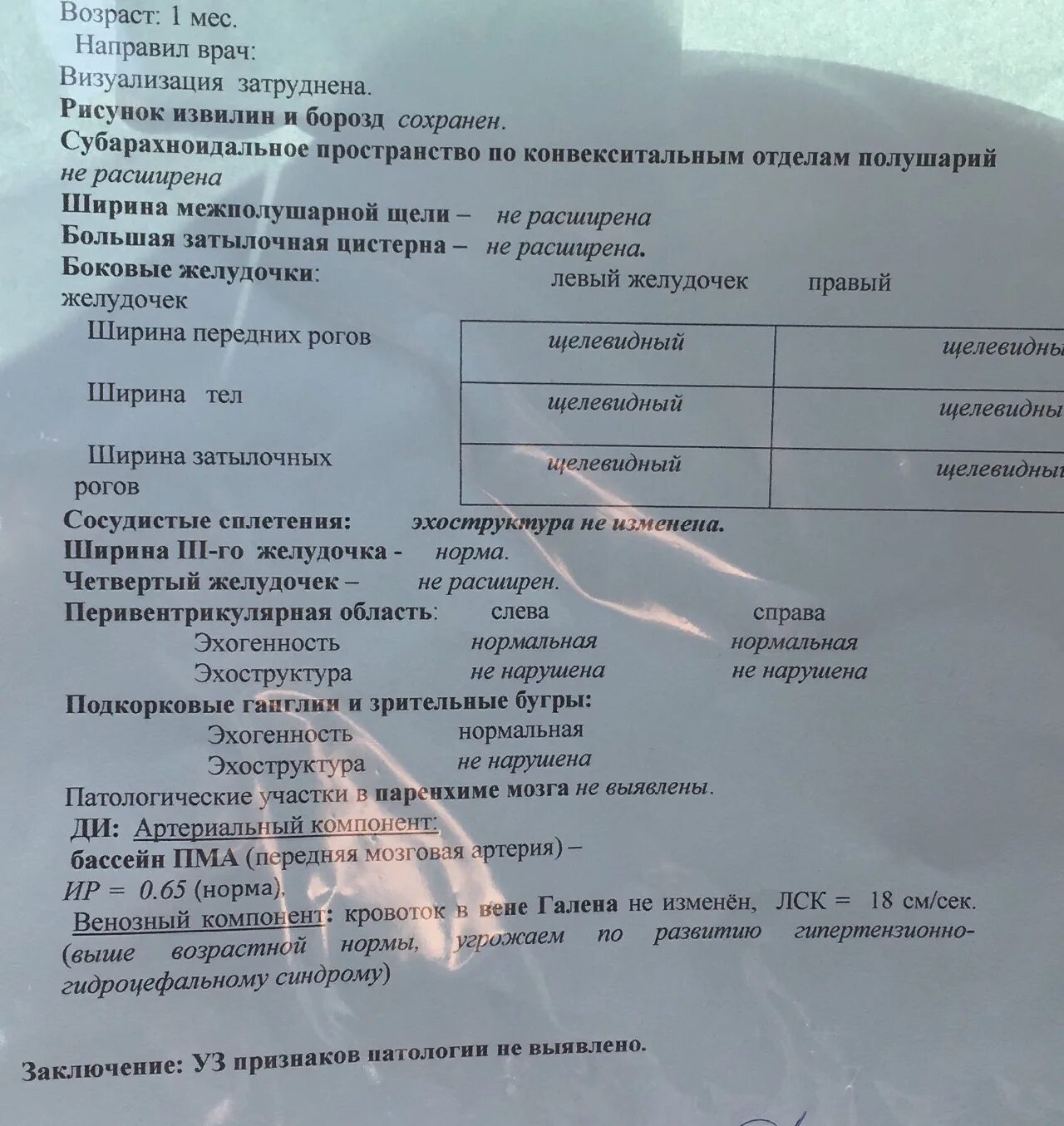Нормы узи головного мозга у грудничка. Липома межполушарной щели на кт. Межполушарная асимметрия головного мозга. Межполушарная липома на кт головного мозга. Межполушарная щель головного мозга.