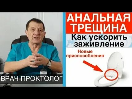 Геморрой трещина заднего прохода