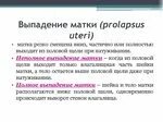 Почему выпадает матка