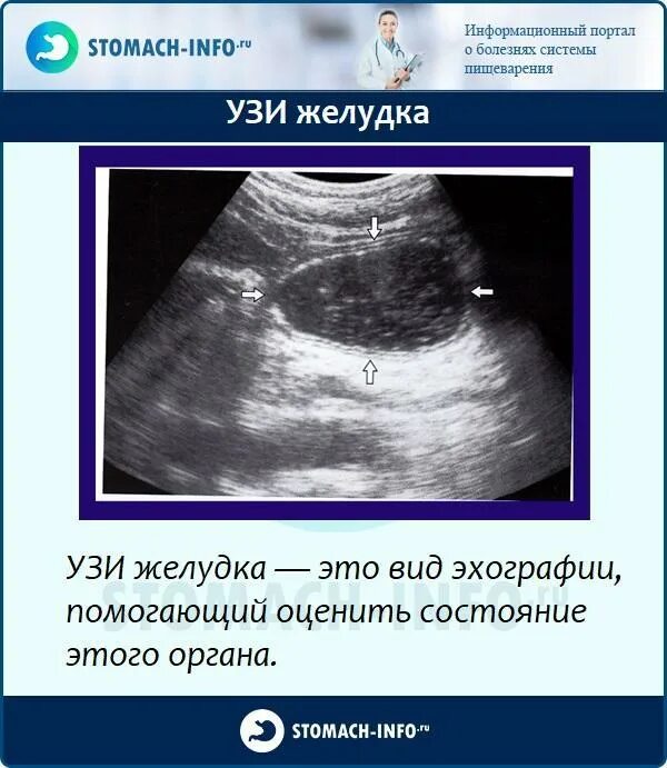 Трансабдоминальное узи желудка. Ультразвуковое исследование органов брюшной полости. Узи живота. Узи органов брюшной полости и почек. Ультразвуковое исследование органов брюшной полости (узи).