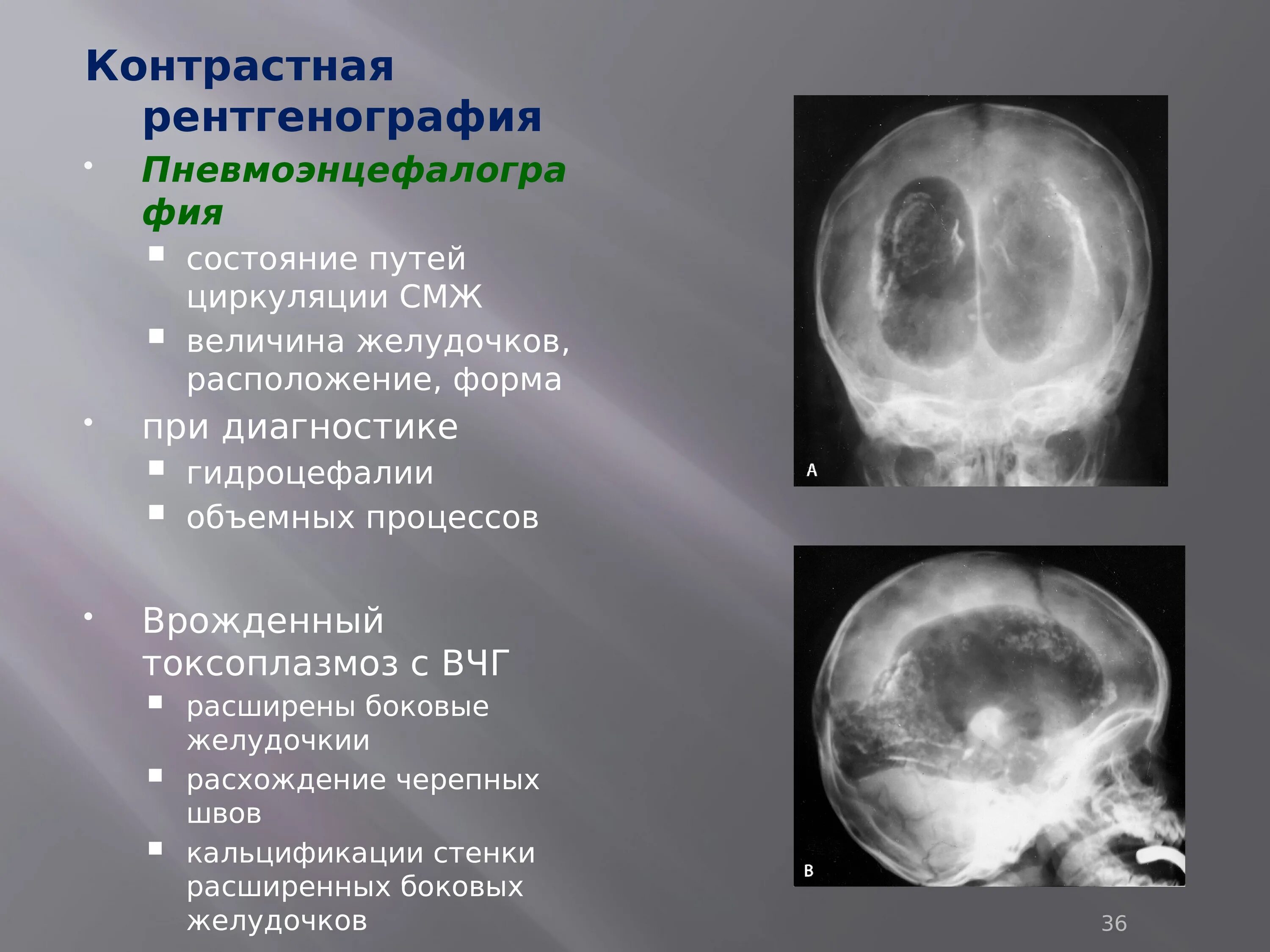 Обзорная рентгеноскопия органов брюшной полости. Контрастный рентгеновский снимок. Контрастность на рентгене. Контрастный рентгеновский снимок. Контрастный рентгеновский снимок.