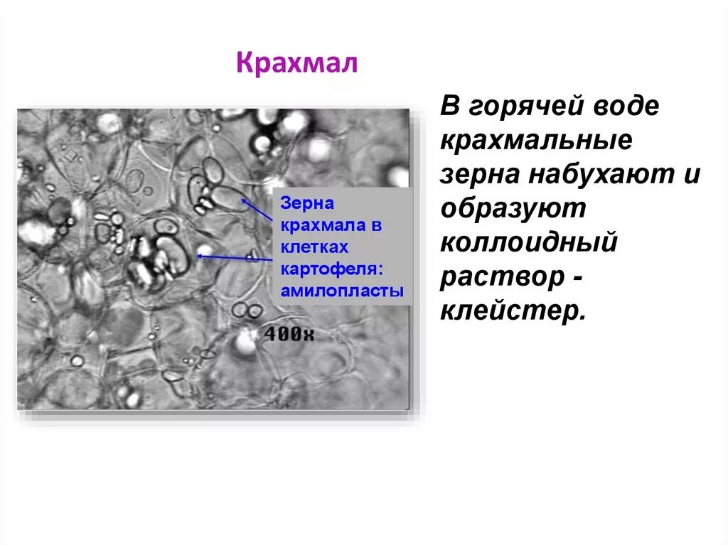 Амилопласт зерен крахмала. Крахмальные зерна под микроскопом. Крахмальные зёрна амилопласты клеток клубня картофеля. Крахмальные зерна картофеля микроскоп.