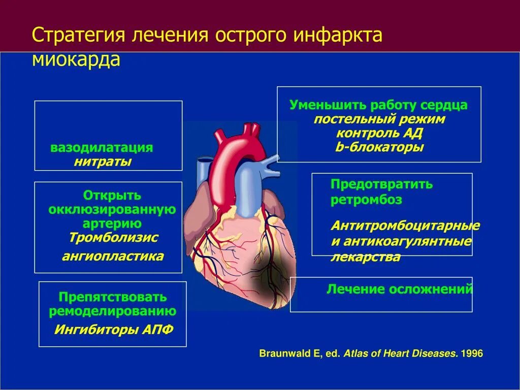 Симптомы ИБС инфаркт миокарда. Острый инфаркт миокарда причины. Острый период инфаркта миокарда клиника.