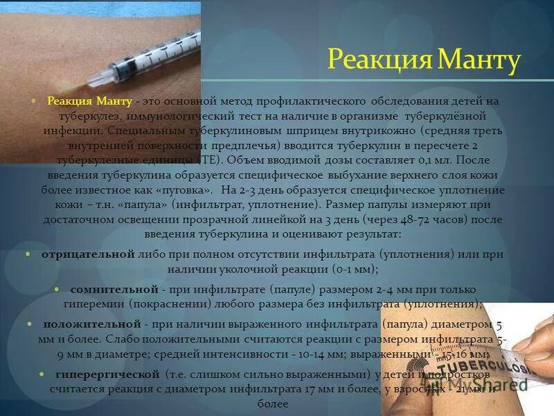 Что означает положительная реакция. Проба манту реакция положительная папула 10мм. Манту прививка реакция норма.