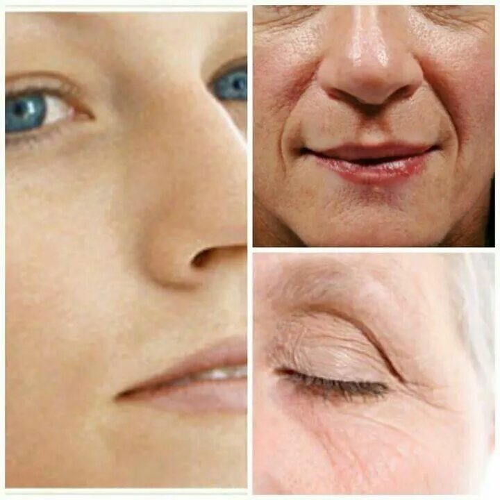 Гусиные лапки на лице. Морщинки лучики у глаз. How to get rid of Wrinkles?. Удалить морщины лучики. Праймер морщины