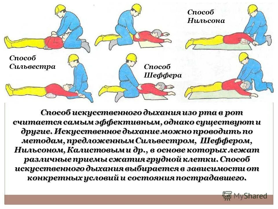 Что самое важное при работе с дыханием. Способ Нильсена искусственное дыхание. Способы искусственного дыхания. Способ Сильвестра искусственное дыхание. Метод проведения искусственного дыхания.