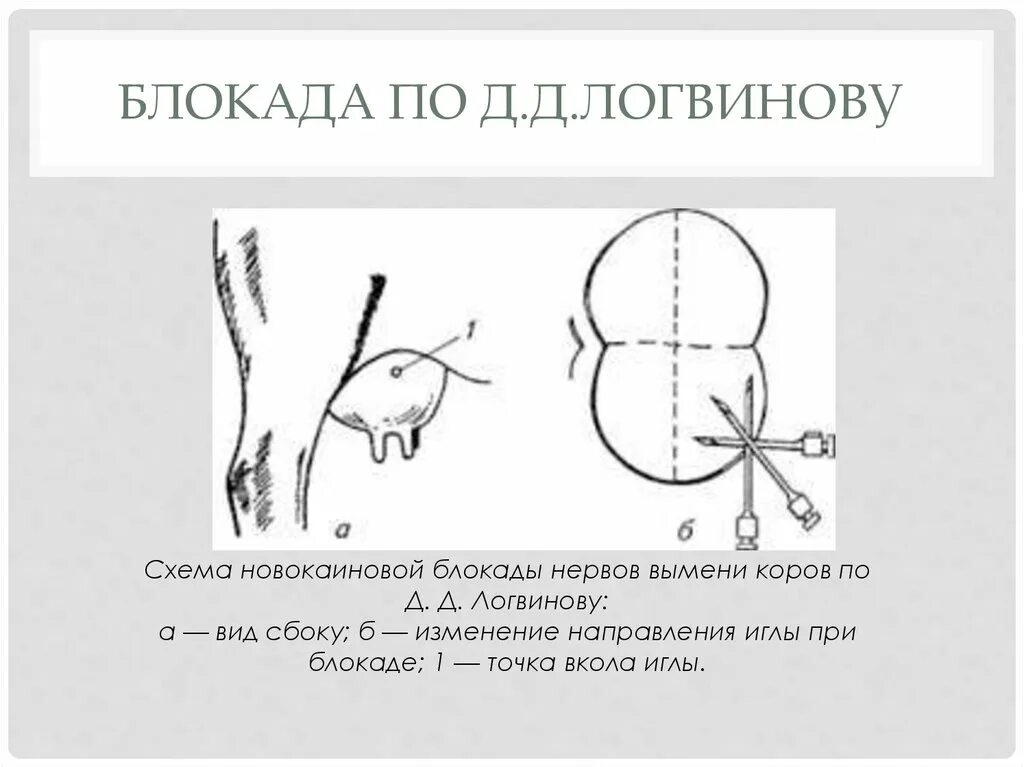 Блокада инструкция. Блокада нервов вымени по д.д.Логвинову.. Блокада вымени у коров по Логвинову. Техника блокады по д. д. Логвинову. Короткая новокаиновая блокада нервов вымени по Логвинову.