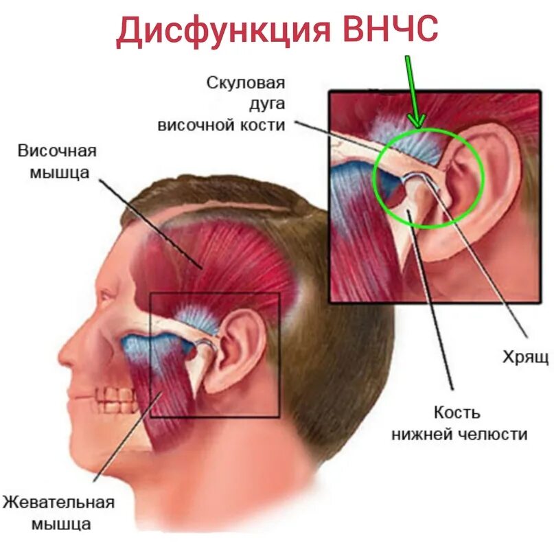 Шумах где находится. Височно верхнечелюстной сустав анатомия. Верхнечелюстной сустав ВНЧС. ВНЧС анатомия кости.