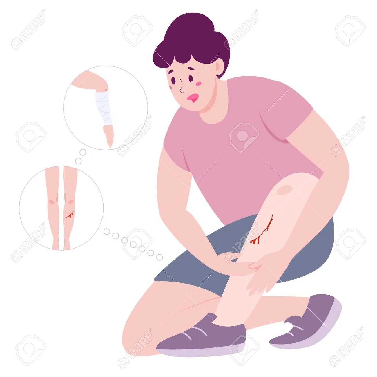 Cut legs. Травма вектор. Человек с больной ногой арт. Нога рана векторный рисунок. Ссадина на коленке рисунок.