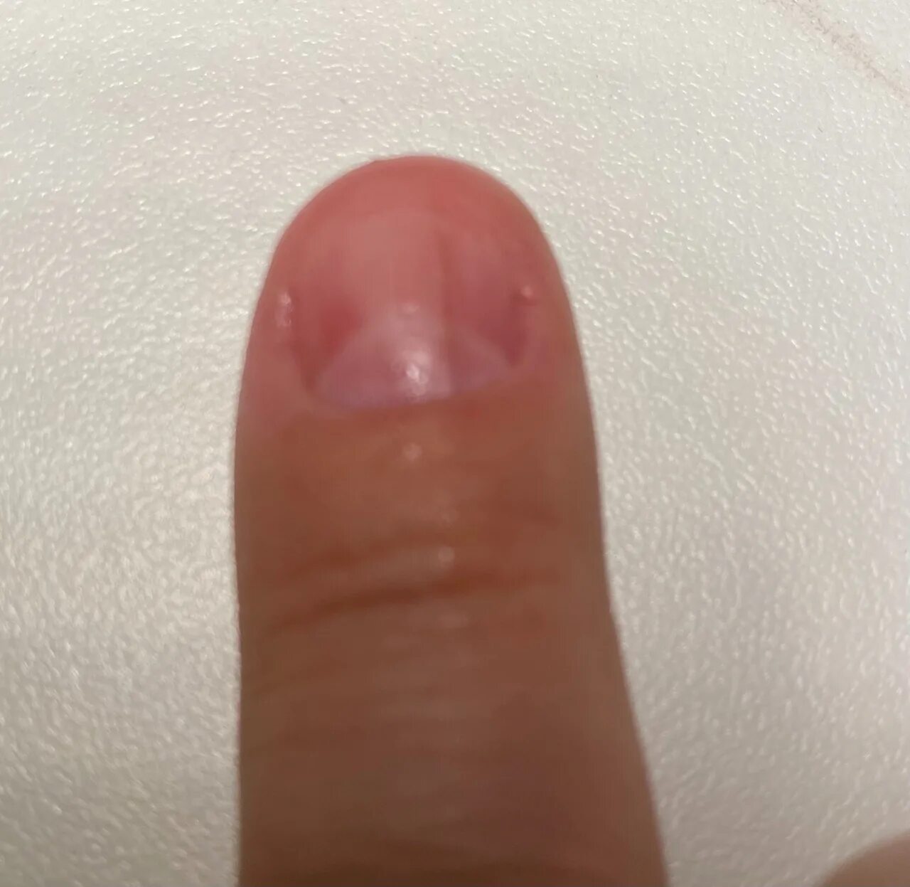 Пятно на ногте указательного пальца. Продольные полоски на ногтях. на указательном пальце на ногте полоска. коричневая полоса на ногте. ноготь указательного пальца.