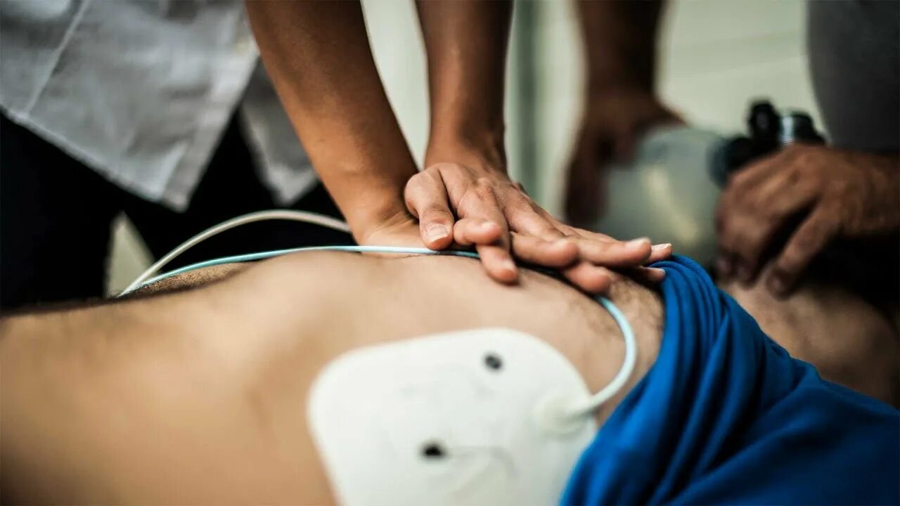 Дефибрилляция при асистолии. Анальный дефибриллятор. дефибриллятор на девушке. дефибрилляция анд.