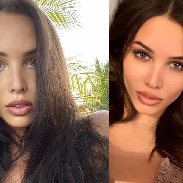 Анастасия Решетова до и после пластики - фото и факты