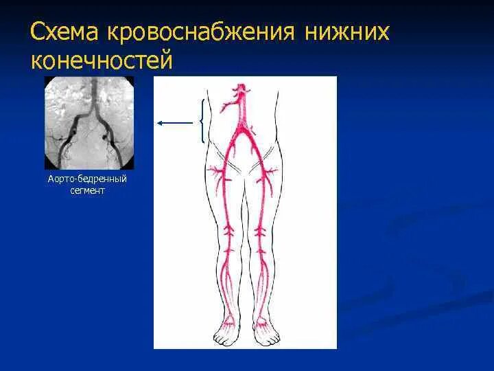 Аорты нижних конечностей. Сегменты артерий нижних конечностей. Артерии нижних конечностей схема. Артерии нижней конечности. Кровоснабжение нижней конечности.