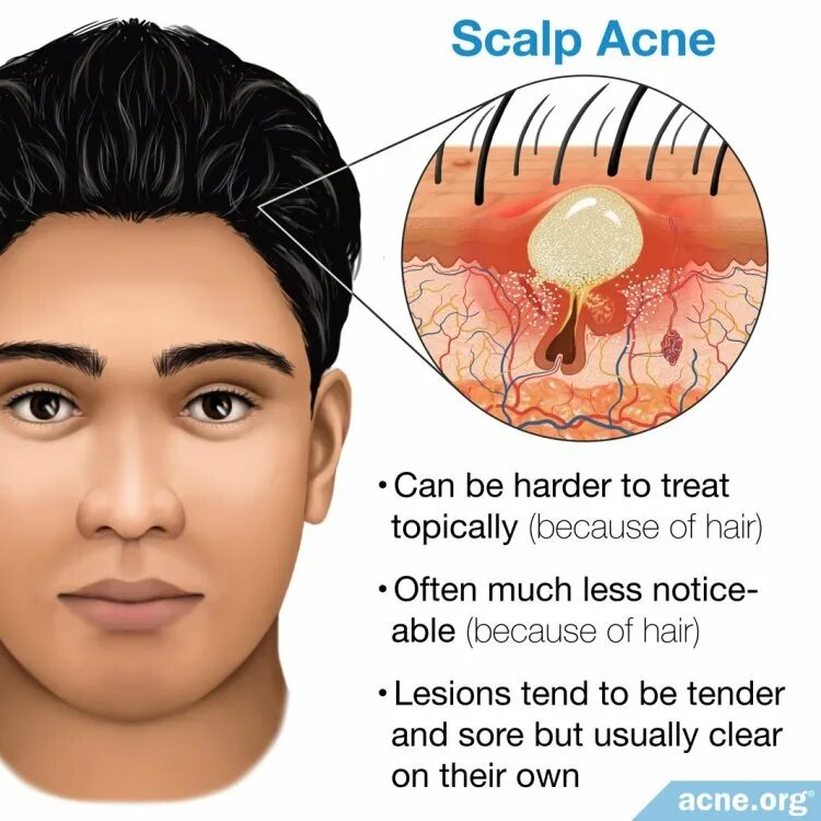 Scalp перевод