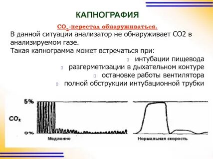 Капнография