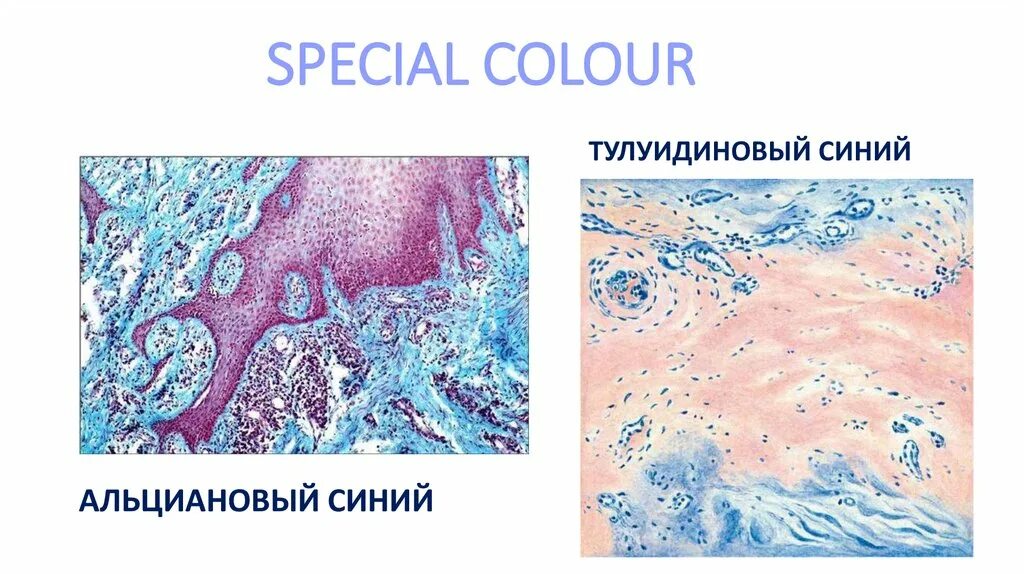 Набухание кожи в воде как называется. Альциановый синий. окраска альциановым синим. мукоидное набухание. альциановый синий гистология.