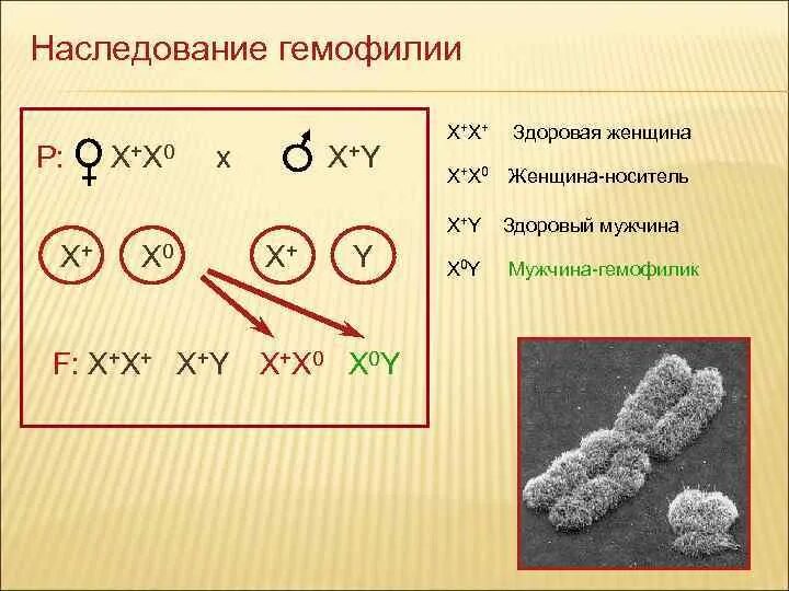 Гемофилия в какой хромосоме. Схема наследования гемофилии. Гемофилия Тип наследования схема. Схема наследования гемофилии у человека. Пример наследования гемофилии.