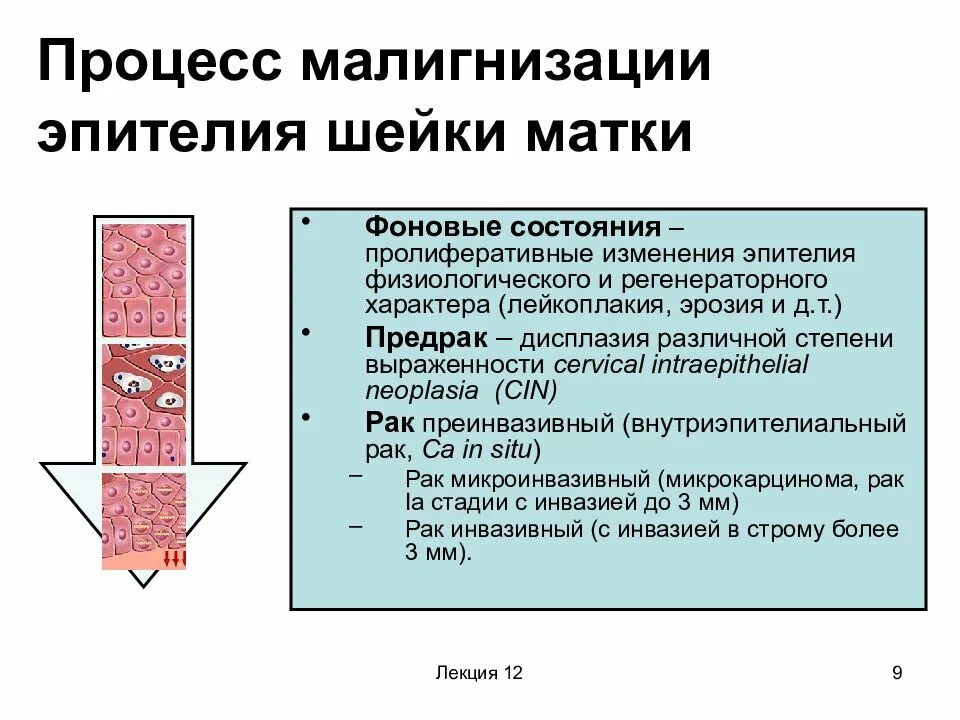 Реактивные изменения шейки. Этапы малигнизации плоского эпителия шейки матки. Лейкоплакия шейки матки. Малигнизация и гиперплазия.