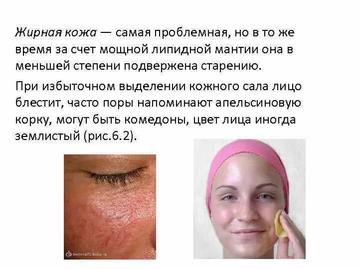 Жирный блеск кожи. Кожа жирнится в течение дня. Чистка лица проблемной кожи. Жирная кожа. Кожа жирнится в течение дня.
