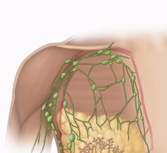 Лимфоузлы подмышечной области анатомия. Лимфатическая система подмышечной области. Подмышечная впадина анатомия лимфоузлы. Увеличен лимфоузел в молочной железе
