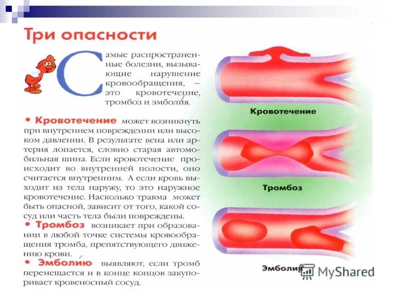 Симптомы образования тромба