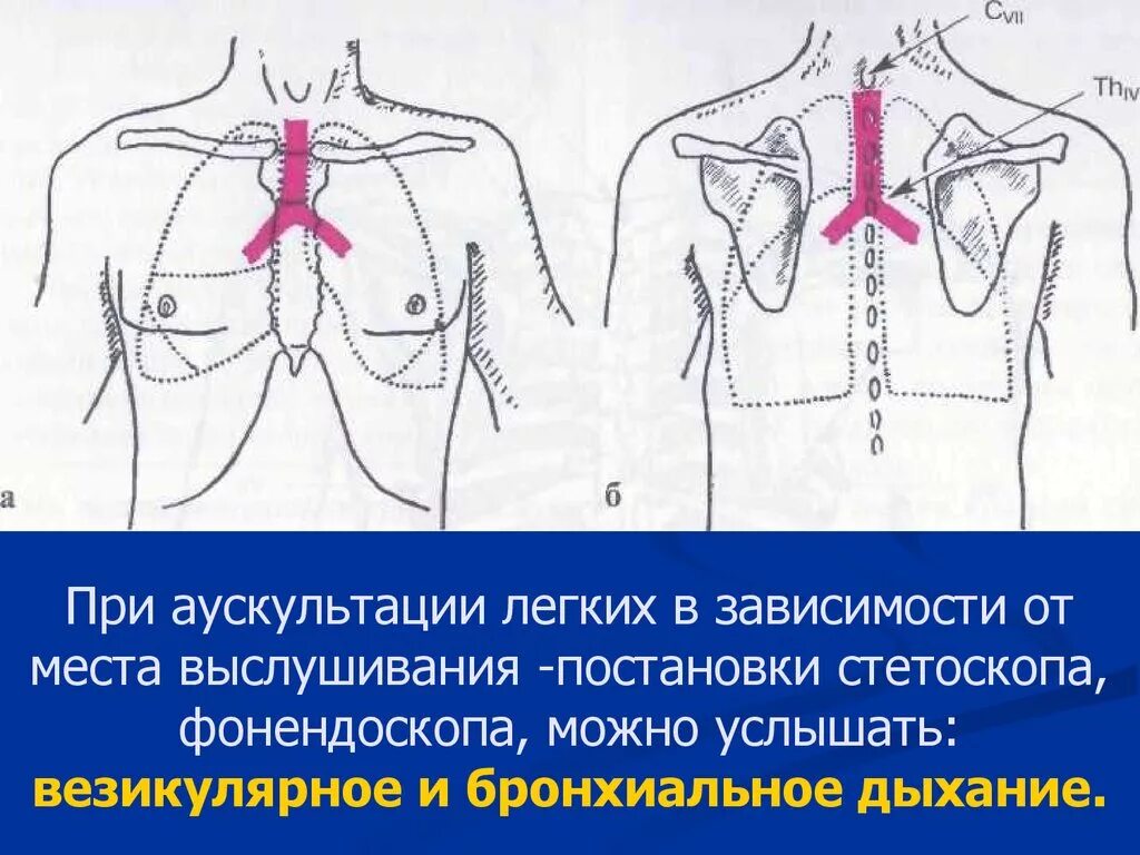 Аускультация везикулярного дыхания. Аускультация дыхания. Места выслушивания легких. Места выслушивания бронхиального дыхания. Бронхиальное дыхание аускультация.