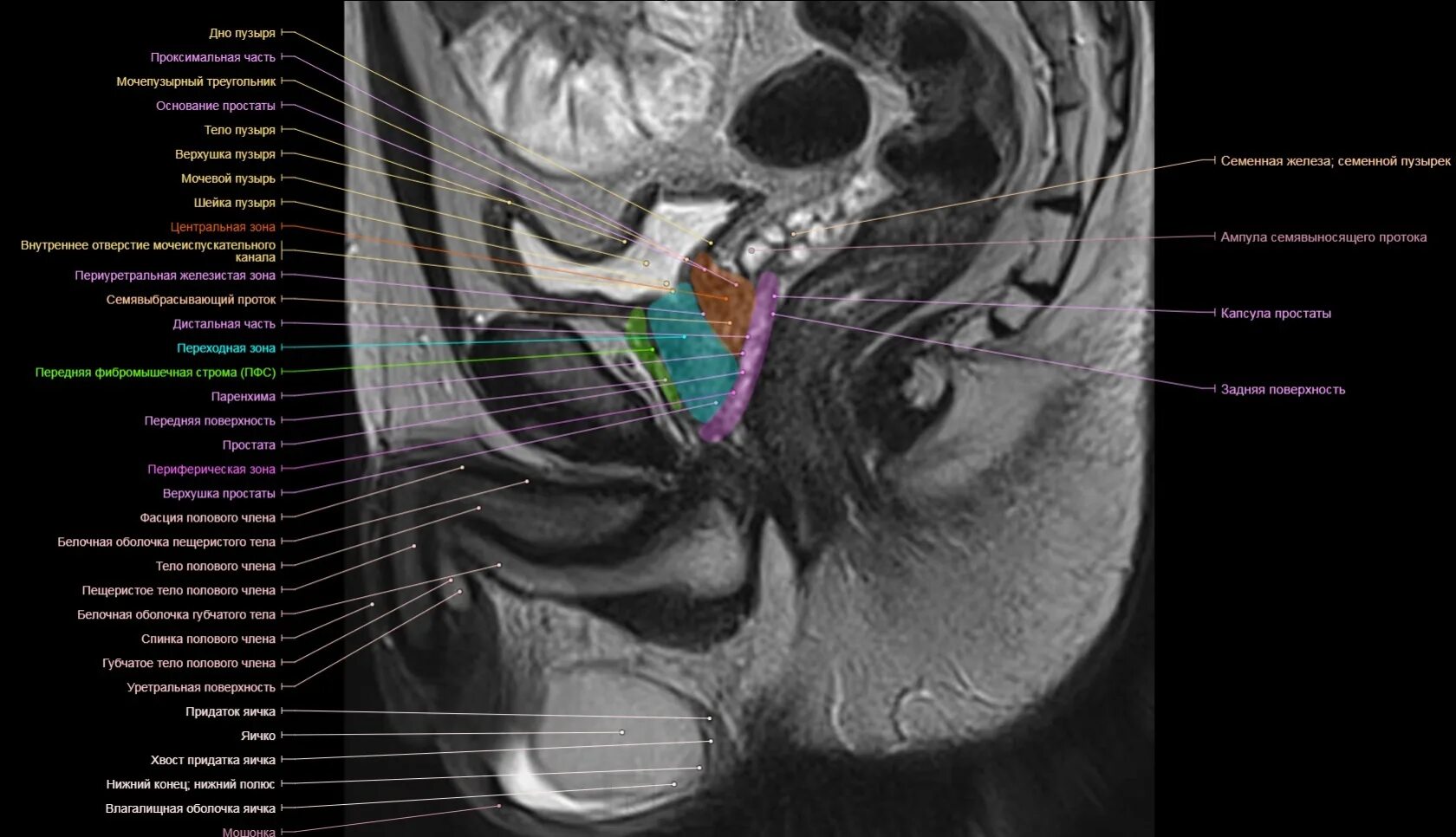 Большие половые органы. Зональная анатомия предстательной железы. Паренхима предстательной железы. Предстательная железа кт анатомия.