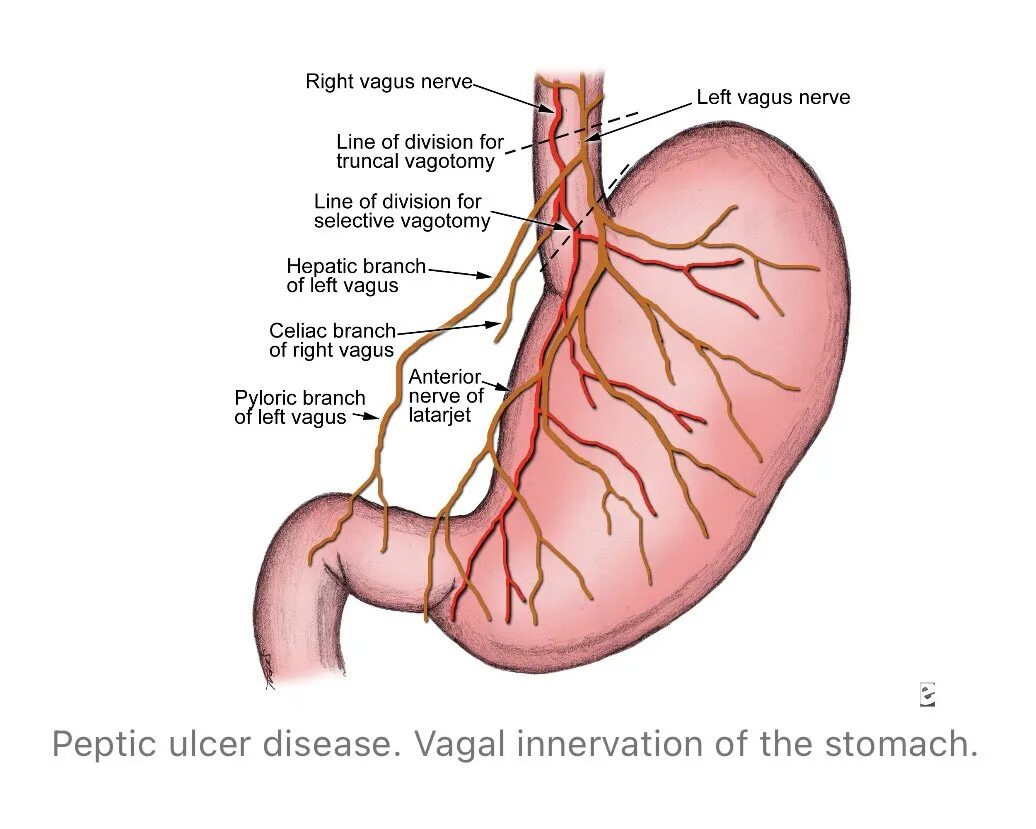 Нерв пищевода. Вагус ЖКТ.