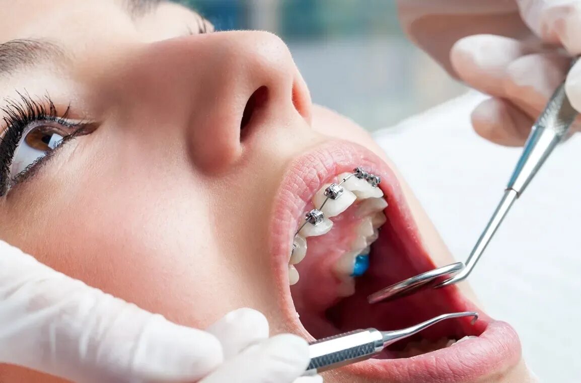 Ортодонтия в стоматологии. Стоматология ортодонт. Оптидант в стоматологии.