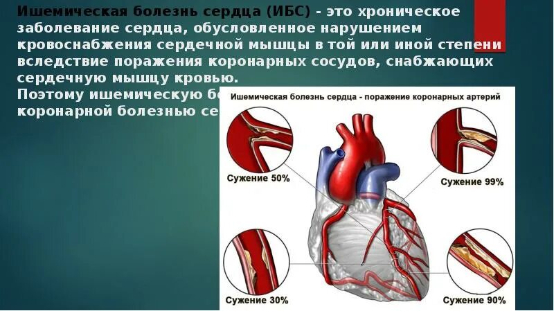 Расширение сердечного сосуда. Ишемическая болезнь сердца (ИБС). Ишемия коронарных сосудов.