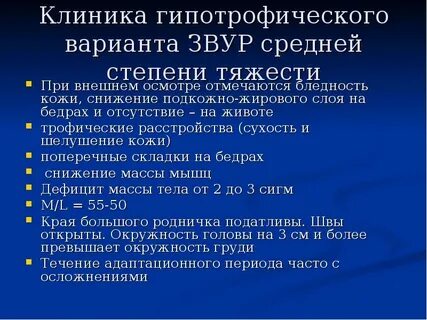 Звур 2
