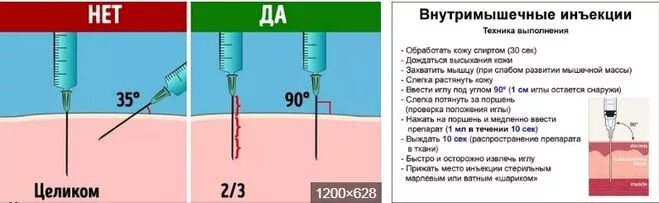 Сколько длится укол. Игла для внутримышечных инъекций вводится. Место введения иглы при внутримышечной инъекции. Длина введения иглы при внутримышечной инъекции. Глубина внутримышечной инъекции.