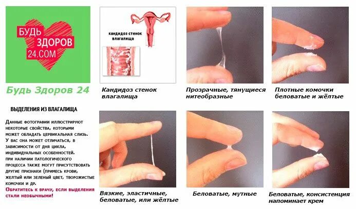 Молочница причины симптомы лечение