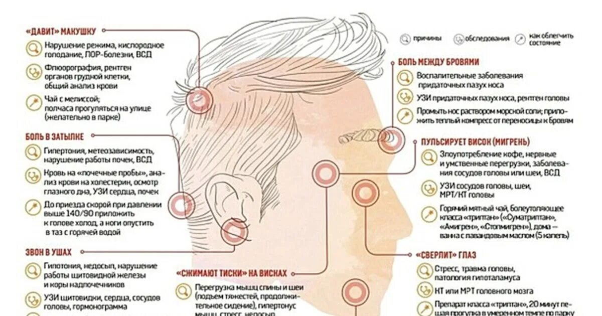 Почему болят виски головы и глаза. Головная боль в затылке. Болит затылок головы. Болит голова вэ. Голованя боль в затылке.