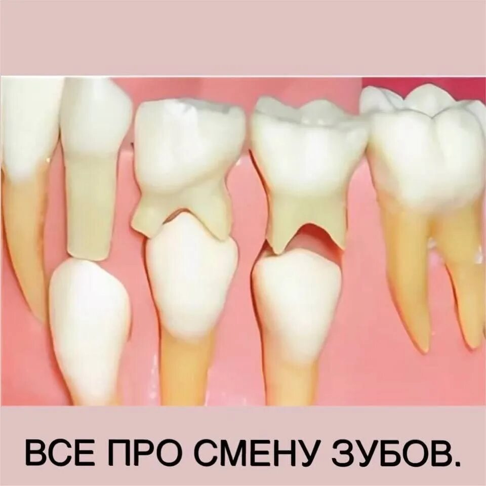 Выпал зуб резец. Молочный зуб резец с корнем. молочные зубы у детей корни.