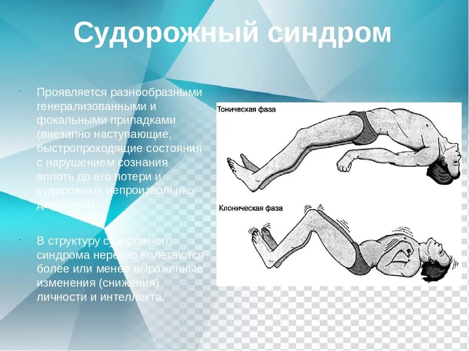 Симптомы при судорожном синдроме. Симптоматические судороги. Проявление судорожного синдрома.