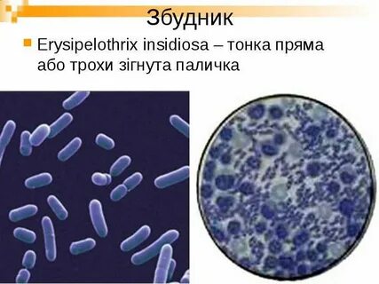 Возбудитель рожи