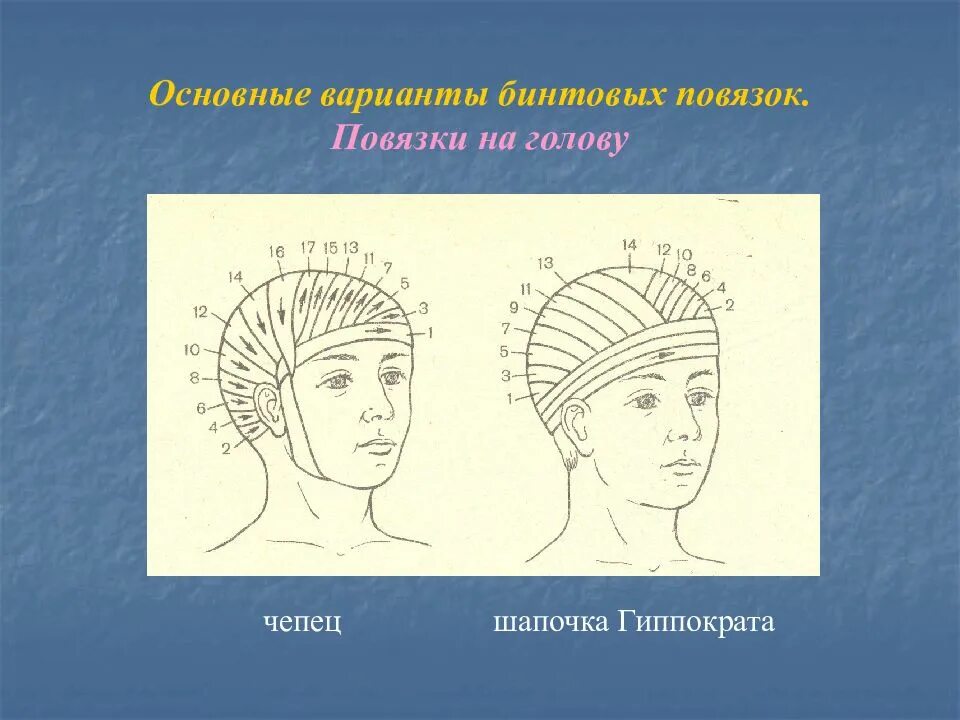 Повязка гиппократа техника наложения. Чепец Гиппократа повязка. Наложение повязки шапочка Гиппократа. Повязка чепец и шапочка Гиппократа. Чепец и шапочка Гиппократа отличия.
