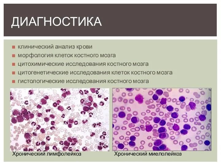 Морфология клетки гистология. Морфология клеток костного мозга. хронический лимфолейкоз костный мозг. хронический миелолейкоз гистология костного мозга.