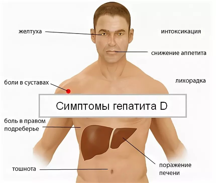 Почему может болеть печень. Клинические проявления гепатита д.