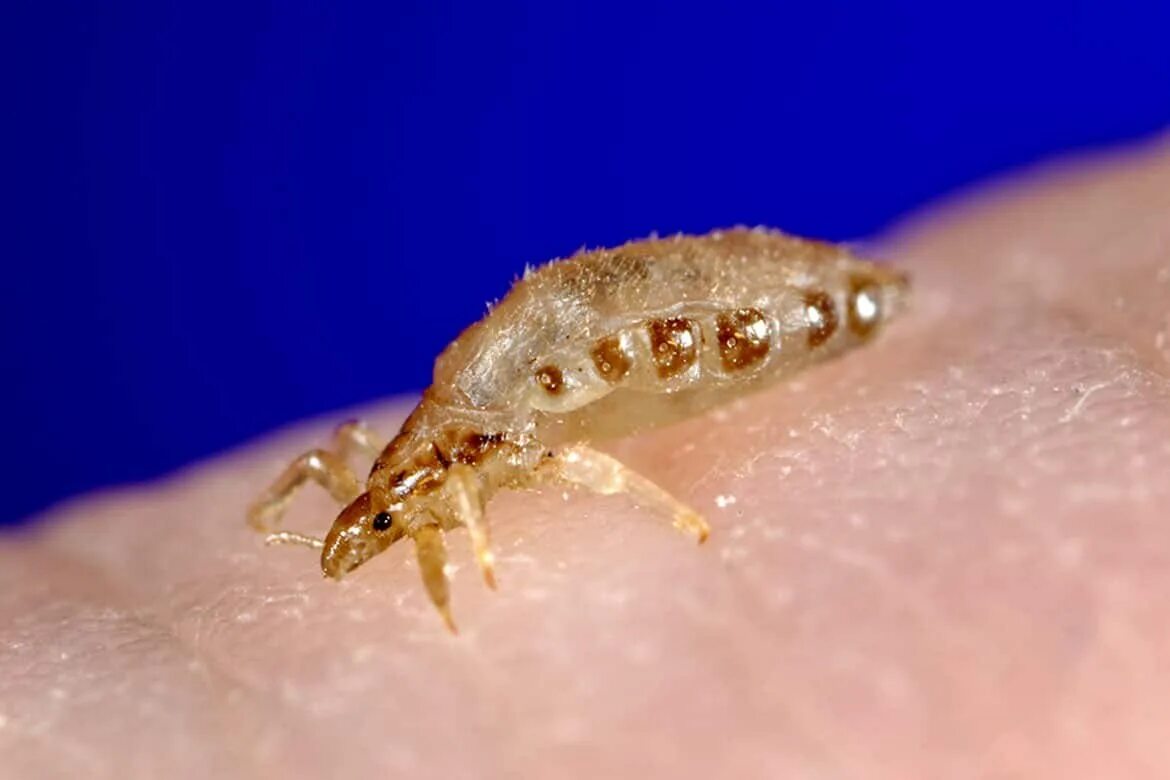 Вши живут в воде. Вошь платяная (pediculus humanus humanus. мандавошки бельевые вши. pediculus humanus, человеческая вошь.