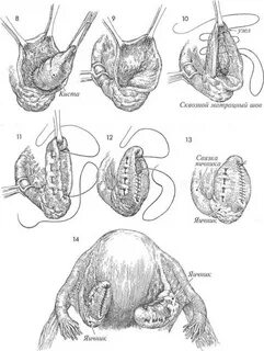 Адамдар кискалармен жыныстық қатынасқа түседі
