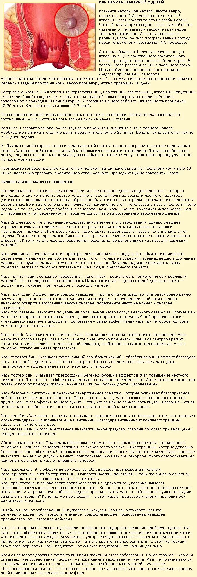 Геморрой лечение у мужчин быстро и эффективно. Народные средства при геморрое. как геморрой лечить геморрой. лечение геморроя народными средствами.